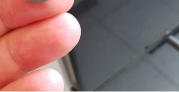 Thumbnail photo by Robert of Starke Arme